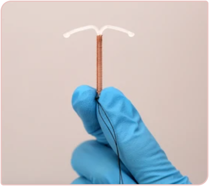 Copper Coil Iud Contraceptive Switzerland Specialist